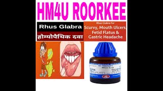 Rhus Glabra/Homoeopathic Medicine To Cure Scurvy, Mouth Ulcers, Fetid Flatus, Gastric Headache.