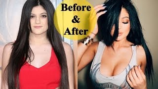 The Amazing Transformation of Kylie Jenner