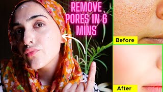 HOW TO REMOVE OPEN PORES + BLACKHEADS IN 6 MINUTES *IT WORKS* ~Immy