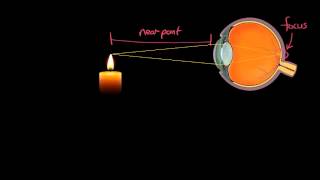 Range of Vision of a Normal Eye - GCSE Physics