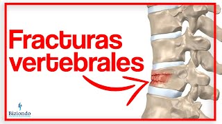 😖 Aplastamiento de vertebras en la columna: ¿Qué son? ¿Cómo tratarlos? | Biziondo