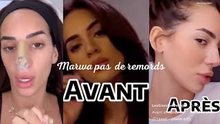 "Marwa (La Villa) réagit aux critiques sur sa chirurgie du nez : révélations sans filtre !"