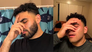 SHAVED BEARD REACTION | MY FACE LOOKS 5 YEARS YOUNGER