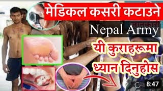 नेपाल् सेना-सैन्य बिस्तुत स्वास्थ परिक्षणमा के-के  चेक हुन्छ Nepal Army full medical Test, 2080