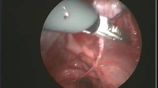 laparoscopic spay male dog criptorchism