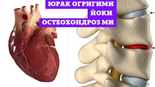 ЮРАК ОГРИГИ ЁКИ ОСТЕОХОНДРОЗ НИ АЖРАТИБ ОЛИШ