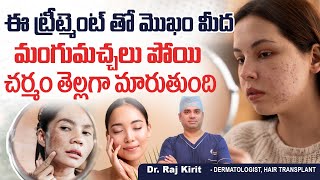 Causes of Black Spots on Face || Best Treatment for Melasma on Face || Celestee Skin And Hair Clinic