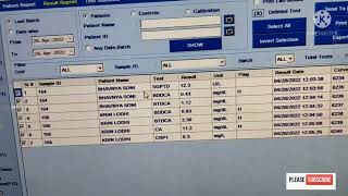 EM-200 fully automatic analyzer par test results kaise dekhe......