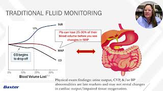 Baxter Hemodynamic Review  Recorded Version   A Craig