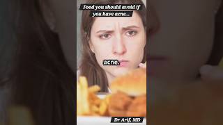 Food and acne @DrArifMDDermatologist