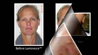 Jeunesse LUMINESCE Cellular Rejuvenation Serum Amazing Before  After Photos