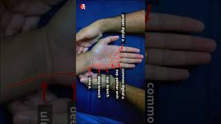 Allens test and arterial supply of hand