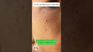 میخوای لاغر شی، خودت رو مقایسه نکن