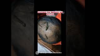 💫Ayurvedic Treatment for Baldness and Hairloss💫