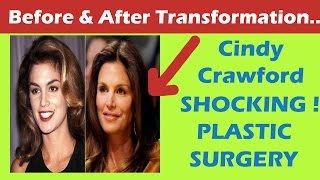 Cindy Crawford Plastic Surgery Before and After HD