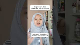 bruntusan selalu jadi masalah