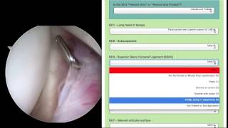 OPAT instructions for the Lateral position