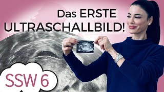 SSW 6: Erstes Ultraschallbild in meiner Schwangerschaft | Fruchthöhle | Mein Kinderwunsch