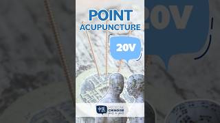 POINT D’ACUPUNCTURE - 20V / Pi Shu #acupuncture #acupuncturepoints #medecinechinoise