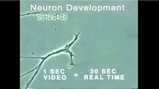 Axon growth & neuron degeneration (mercury exposure)