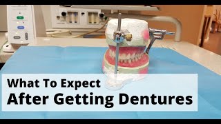 What To Expect After You Get Your Dentures - Parkway Dentistry