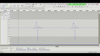 ECG(Electrocardiograph) processed waves