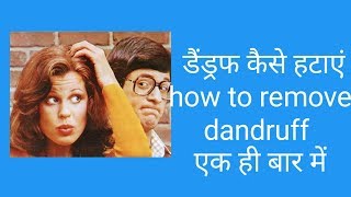 Dandruff Kaise hataye/ how to get rid of dandruff