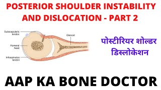 POSTERIOR SHOULDER INSTABILITY AND DISLOCATION = PART 2 - EPISODE - 38