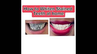 How to whitening Teeth in 2 minute. @dralanmandell2688 @100HomemadeGhareluNuskhe a