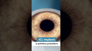 Generally painless with quick recovery. Mild discomfort possible. #ICLSurgery #EyeHealth