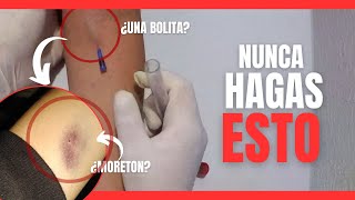 Este ERROR no lo DEBES DE COMETER al MOMENTO DE CANALIZAR 💉 | Enfermeria