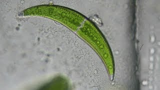 Crescent Shaped Algae: Closterium moniliferum