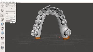 Using Meshmixer to Print Dental Models Vertically