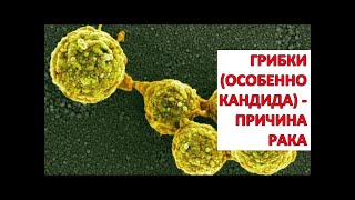 Грибковые заболевания, ГРИБКИ (особенно Кандида) - причина РАКА (онкологии) / Фролов Ю.А.