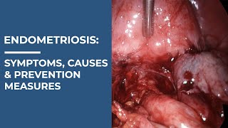 Endometriosis : Know the Symptoms, Causes & Prevention Measures | Healthie Genie