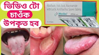 mosiba tablet || mosiba tablet benefits ||mosiba tablet review || mouth ulcer || health tips ikbal