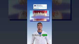 PERIODONTITIS - La principal CAUSA de PÉRDIDA de DIENTES en adultos