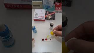 ABO Blood group system | ABO blood typing | blood grouping | know your blood type | Hematology