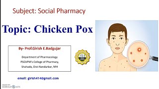 Chicken pox: Causative agent, Symptoms, Prevention and control #Social Pharmacy