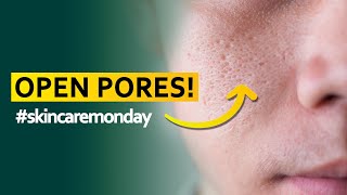 Open Pores! | Dr. Charanya