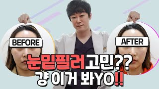 눈밑필러 시리즈 4탄. 눈밑꺼짐 타입별로 해결하기 by 피부과전문의 닥터개굴