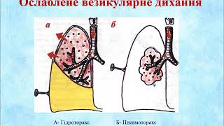 Обстеження хворих із захв  орг  дихання ФТЕТ 2019 2020 р