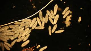 Paramecium