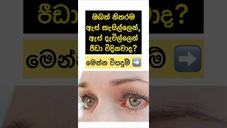 නිතරම ඇස්වල ප්‍රශ්න ඇති අයට😲✨ #shorts #sinhala #health #viral