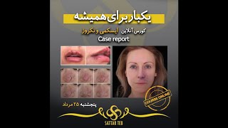 کورس آنلاین ایسکمی تا نکروز (بررسی علائم و تظاهرات بالینی در تمام مراحل)