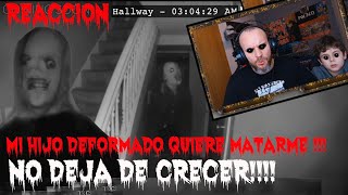 "MI HIJO DEFORMADO QUIERE MATARME" SU HIJO NO PUEDE DEJAR DE CRECER DE NOCHE!!!!  REACCION