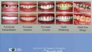 Unforgettable Smile- Beverly Hills California Dentist ...