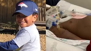 Family Pit Bull destroyed child's face