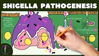 Shigella Pathogenesis Simplified