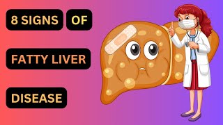 Signs and Symptoms of Fatty liver